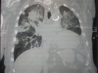 CAP, CURB, PSI, SEPSI, CICCI’ E&nbsp;COCCO’